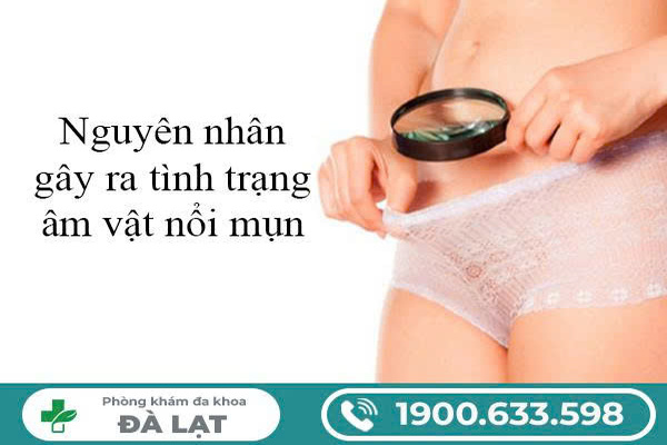 Hình ảnh minh họa